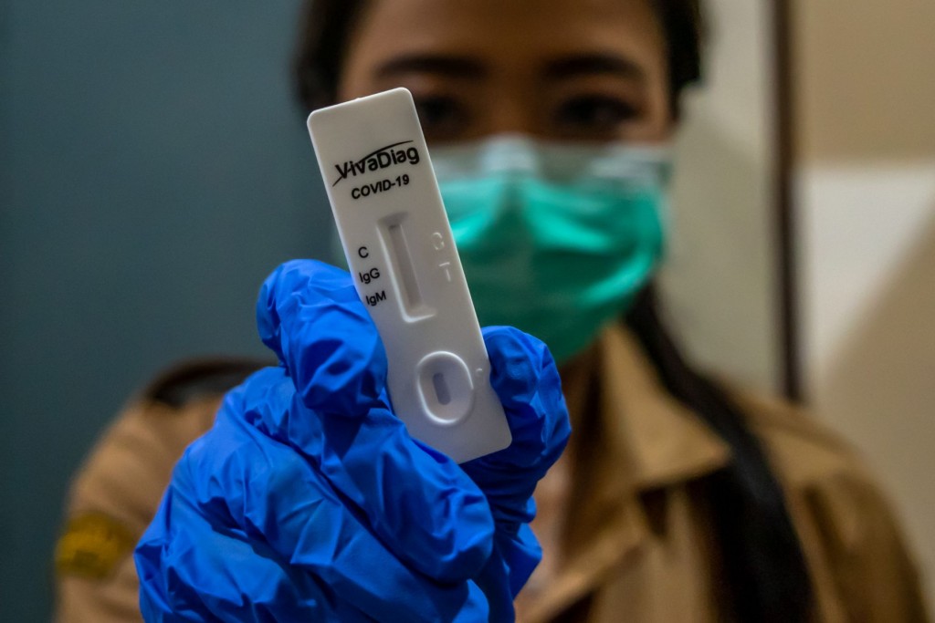 17390 Alat Rapid Test Sudah Digunakan Di Jakarta Selatan | Detak.co ...