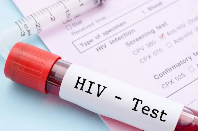 Kemenkes: Temuan HIV di Sidoarjo Naik karena Skrining Semakin Luas
